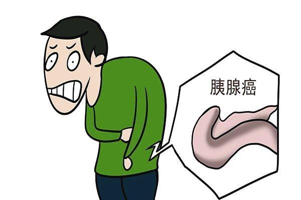 郑州中医：吸烟过多会导致胰腺癌吗